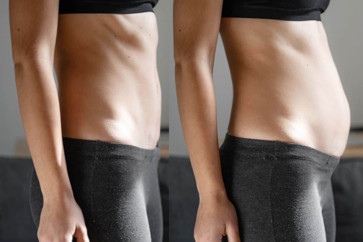 How long does diastasis recti take to improve Oxshott?