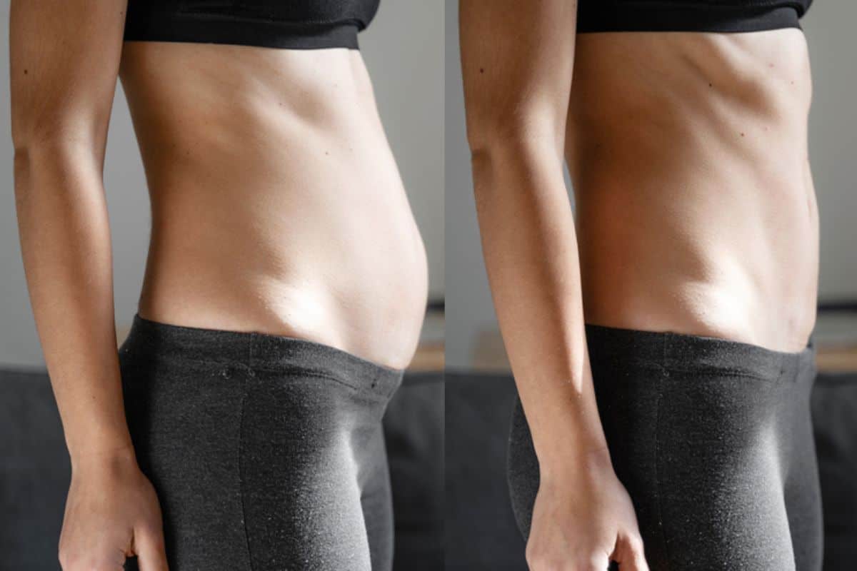 Post-Pregnancy: What Happens to Your Abdominal Muscles After Birth Oxshott