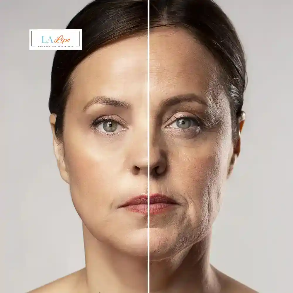 How Can You Tell If Non-Surgical Skin Tightening Is Right for You Oxshott?