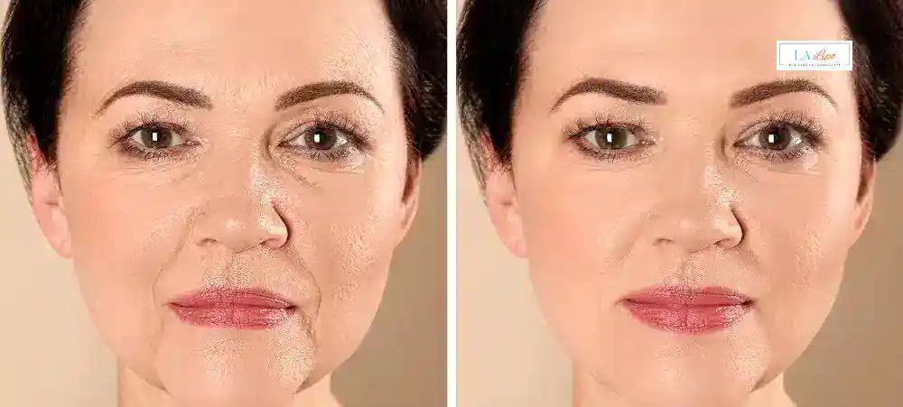 Why Aren’t My Skincare Products Making My Sagging Skin Look Firmer Oxshott?