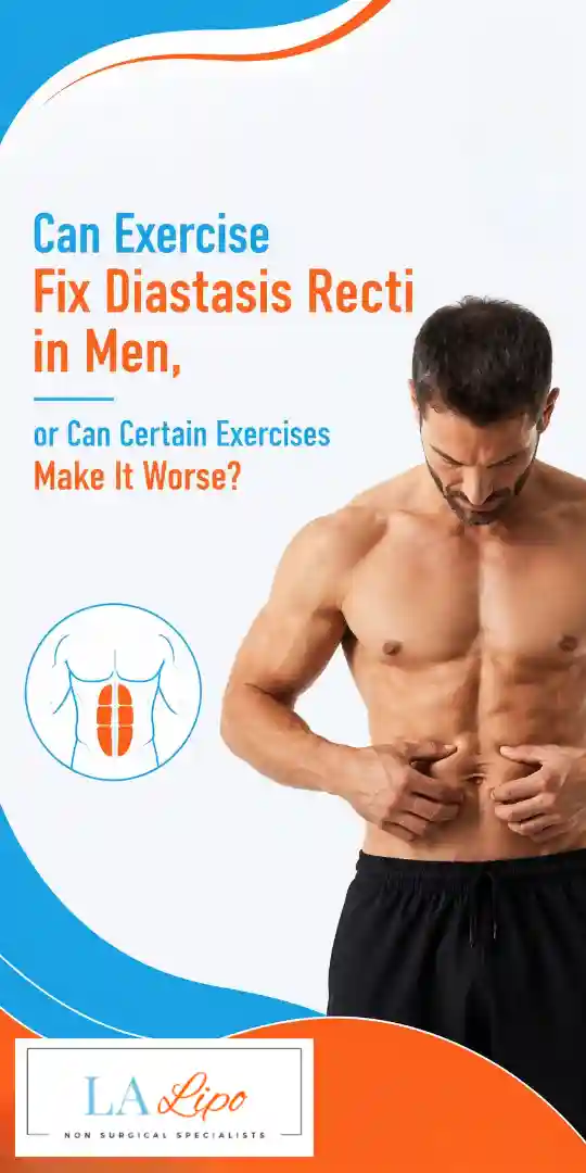 Can Exercise Fix Diastasis Recti in Men, or Can Certain Exercises Make It Worse Oxshott?