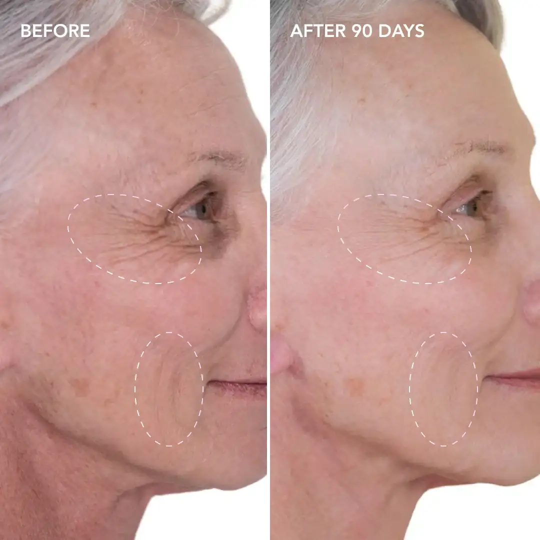 When will you see results Oxshott
